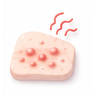 Allergic Skin Conditions