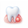 Dental Infections