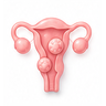 Fibroids