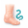 Filariasis