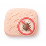 Scabies